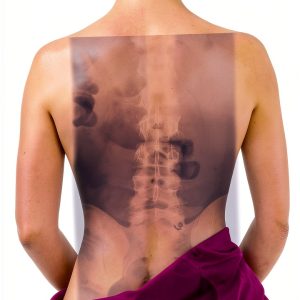 Osteoporosis and Rheumatology Guide by Axios Press-0